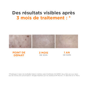ISDIN Eryfotona AK-NMSC SPF 100+ 50ml